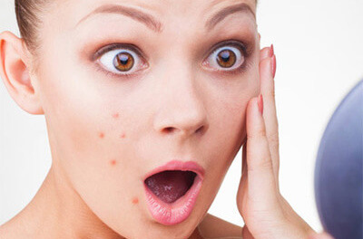 Alternate Acne Treatment wonderful lοοking epidermis