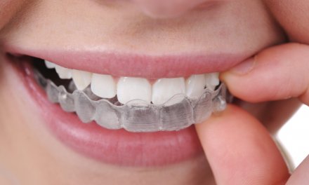 6 Major Dissimilarities between the Braces and Invisible Braces