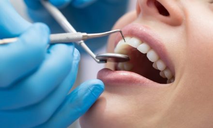 Life Will Knock Your Teeth Out At Least Twice In Your Lifetime: Know the Common Dental Injuries