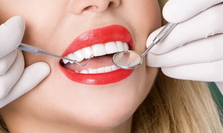 Get Pearly White Teeth With Professional Teeth Whitening