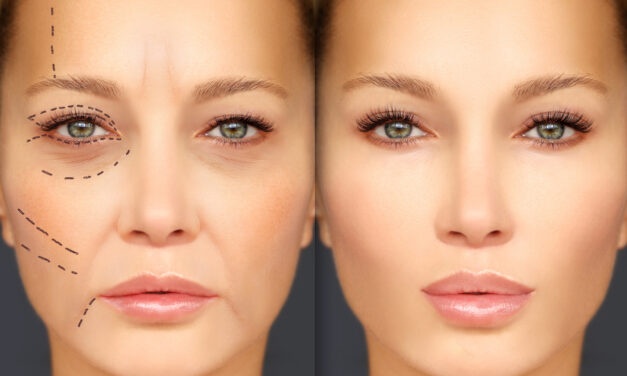Is Plastic Surgery Right for You?