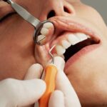 How to Care for Your Teen After Their Wisdom Teeth Are Pulled